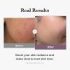imageMedicube All Over Glow Skin Duo Deep Vitamin C Golden Capsule Face Moisturizer and AgeR Glutathione Glow Milky Toner