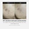 imageMedicube Deep Vita C Serum 20  145 Pure Vitamin C reduce the appearance of hyperpigmentation dark spots and blemishes  16 selftests complete  Korean skincare 10g  3 bottles