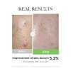 imageMedicube Exosome Cica Tea Tree Ampoule for Sensitive Skin with Centella Asiatica help reduce redness and breakouts Lowirritating Moisturizing ampamp Soothing Serum  Korean Skincare  30ml