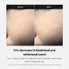 imageMedicube Zero Pore Oneday Serum 101 floz  Overnight Resurfacing Serum with Pore Tightening Complex  152 AHABHAPHA ampamp 2 Niacinamide  108 reduction in pore appearance after one day of use