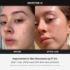 imagemedicube Booster H  Korean Skincare Tool  Facial Glow Booster for Maximizing and Boosting Skin Care Absorption  Needle Free
