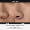 imagemedicube Booster H  Korean Skincare Tool  Facial Glow Booster for Maximizing and Boosting Skin Care Absorption  Needle Free