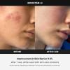 imagemedicube Booster H  Korean Skincare Tool  Facial Glow Booster for Maximizing and Boosting Skin Care Absorption  Needle Free