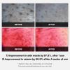 imagemedicube Exosome CICA Tea Tree Calming Toner Pads for Sensitive Skin with Centella Asiatica Help Reduce Redness ampamp breakouts Lowirritating ampamp Hydrating Daily Care Korean Skincare Vegan 100 PadsRed Succinic Acid Peeling Pads