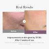 imageMedicube AGER Glutathione Glow Capsule Facial Cream  Instant Lifting Moisturizer  Collagen Peptide For Hydrating Glow  Improve Blemishes Uneven Skin Tone  Korean Skin Care 169 floz