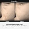 imageMedicube AgeR ATS Air Shot  Microneedling Skin Care Device for Pore Tightening Enhanced Absorption and Smoother Skin Texture  Exfoliation and Skin Rejuvenation  Korean Skincare