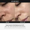 imageMedicube AgeR ATS Air Shot  Microneedling Skin Care Device for Pore Tightening Enhanced Absorption and Smoother Skin Texture  Exfoliation and Skin Rejuvenation  Korean Skincare