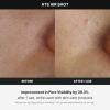imageMedicube AgeR ATS Air Shot  Microneedling Skin Care Device for Pore Tightening Enhanced Absorption and Smoother Skin Texture  Exfoliation and Skin Rejuvenation  Korean Skincare