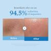 imagemedicube Smooth Pore Double Cleanse Set Zero Pore Blackhead Cleansing Oil and Zero Pore Clear Blue Capsule Facial Cleanser