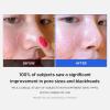 imageMedicube AllinOne Duo for Pore and Skin Texture Care Zero Pore Pads 20 and Zero Pore Blackhead Mud Facial Mask