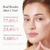 imagemedicube PDRN Peptide Jelly Gloss Balm  Moisturizing Lip Gloss with Pink Peptide Hyaluronic Acid Ceramide ampamp Shea Butter  Clear Gloss with Silver Pearl for a Plump Glossy Lips  10g
