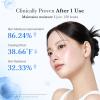 imagemedicube Hyaluronic Acid Capsule Cream  120H LongLasting Hydration Barrier Care ampamp Calming Daily Facial Moisturizer For All Skin Types  With Hyaluronic Acid Panthenol ampamp Ceramides  Korean Skincare