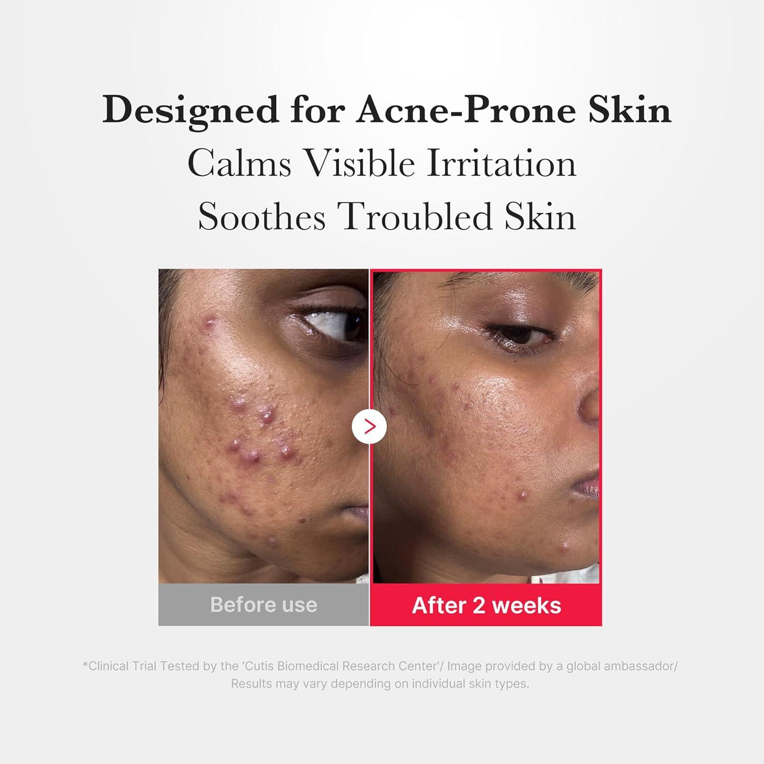 imagemedicube Power Soothing Spray  Hypochlorous Acid Spray For All Skin Types Delicate Skin  Daily Skin Solution ampamp PostSun Care  HOCI Facial Mist for Soothing ampamp Calming  Korean Skincare  169 floz125 ml