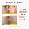 image:imagemedicube Dual Peel Shot Exfoliating Duo Hypochlorous Acid and Turmeric Facial Peel Shots  Targeted Pore Excess Sebum amp Texture Care  Soothing amp Calming with HOCI amp Turmeric  Hydrating Glow Care