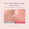 image:imagemedicube Ultimate Clear Glass Skin Serum Duo TXA  Niacinamide 15 Glow Facial Serum and PDRN Pink Peptide Serum for Uneven Skin Tone and Texture  Korean Skincare