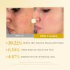 image:imagemedicube Kojic Acid Turmeric Peel amp Tone Facial Duo Turmeric Peel Shot and Kojic Acid Smoothing Toner  Gentle Facial Exfoliation amp ToneRefining Care for Uneven Skin Tone amp Texture
