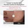image:imagemedicube Clear amp Calm Skin Duo Hypochlorous Acid Peel Shot and 3H Relief Cream  Gentle Exfoliating Serum for Dead Skin Cells and Calm with Daily Soothing Moisturizer  For Clearer Smoother Skin